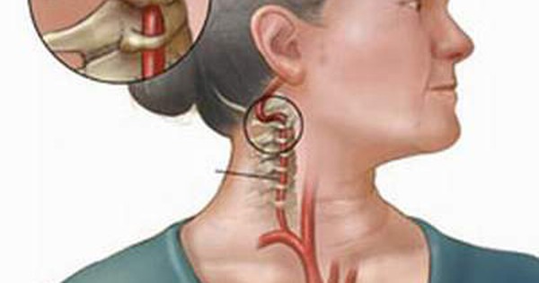 Có những phương pháp chẩn đoán nào để xác định nguyên nhân gây đau khi ấn vào đỉnh đầu?
